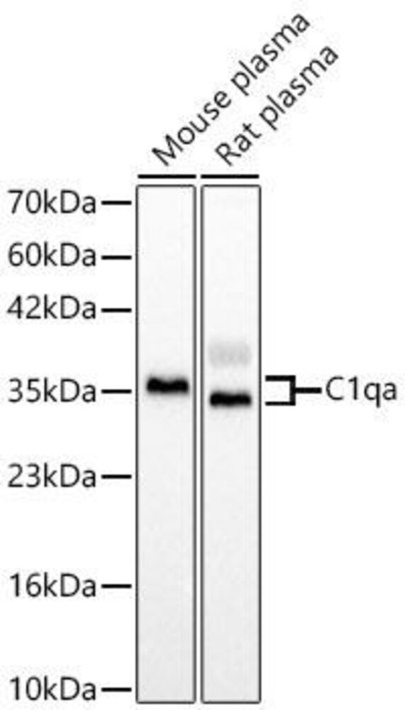 Anti-C1QA Antibody, 100 µl