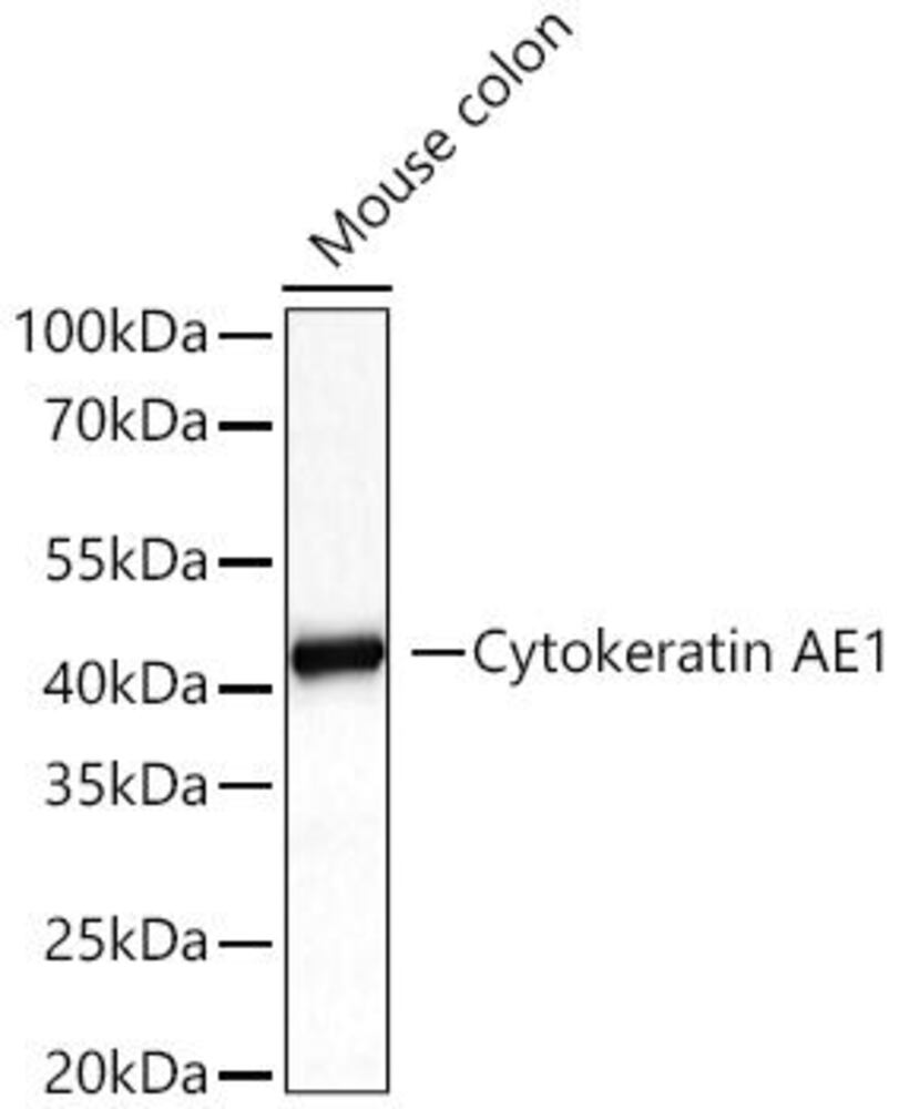 Anti-Cytokeratin 10 Antibody