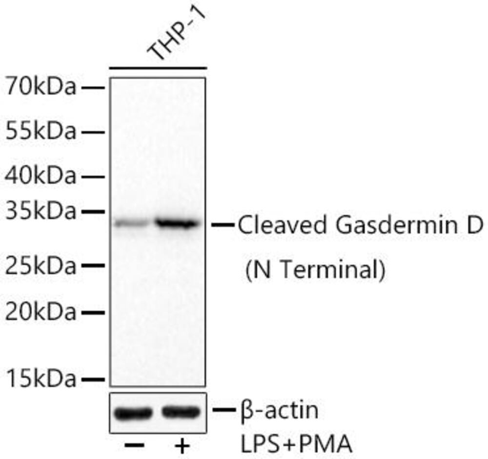 Anti-GSDMD Antibody [ARC57989]