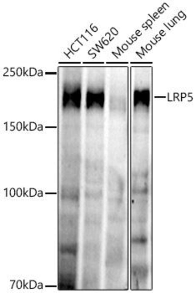 Anti-LRP5 Antibody [ARC52451]