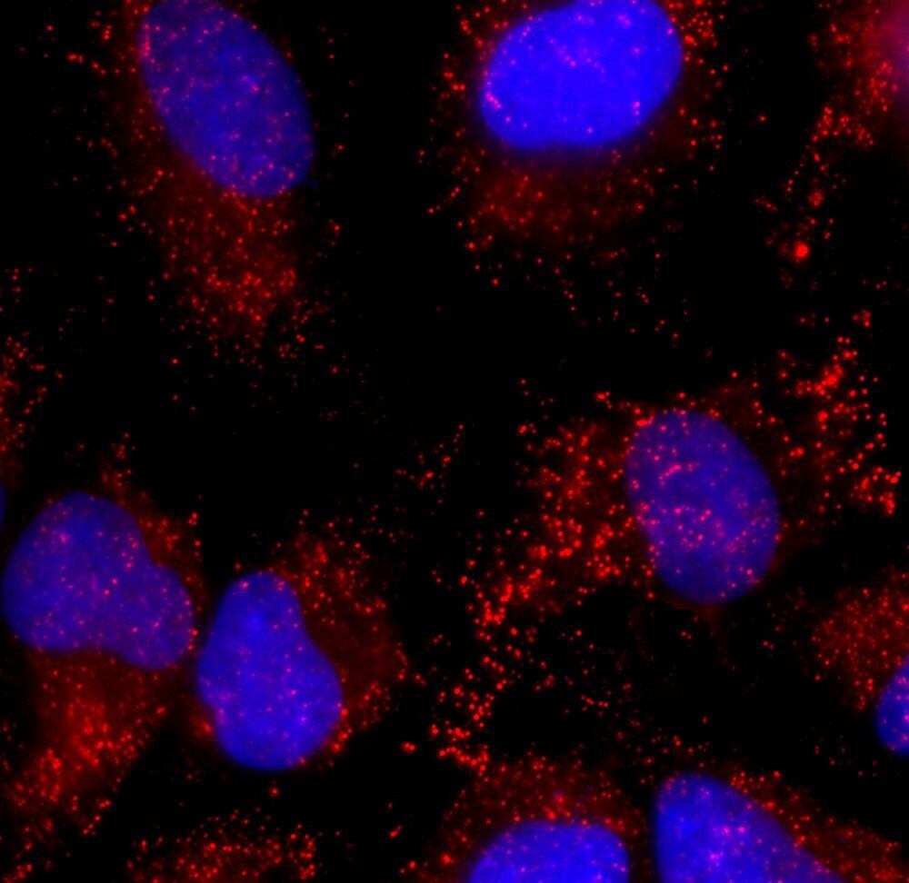 Anti-Catalase Antibody [6H14]