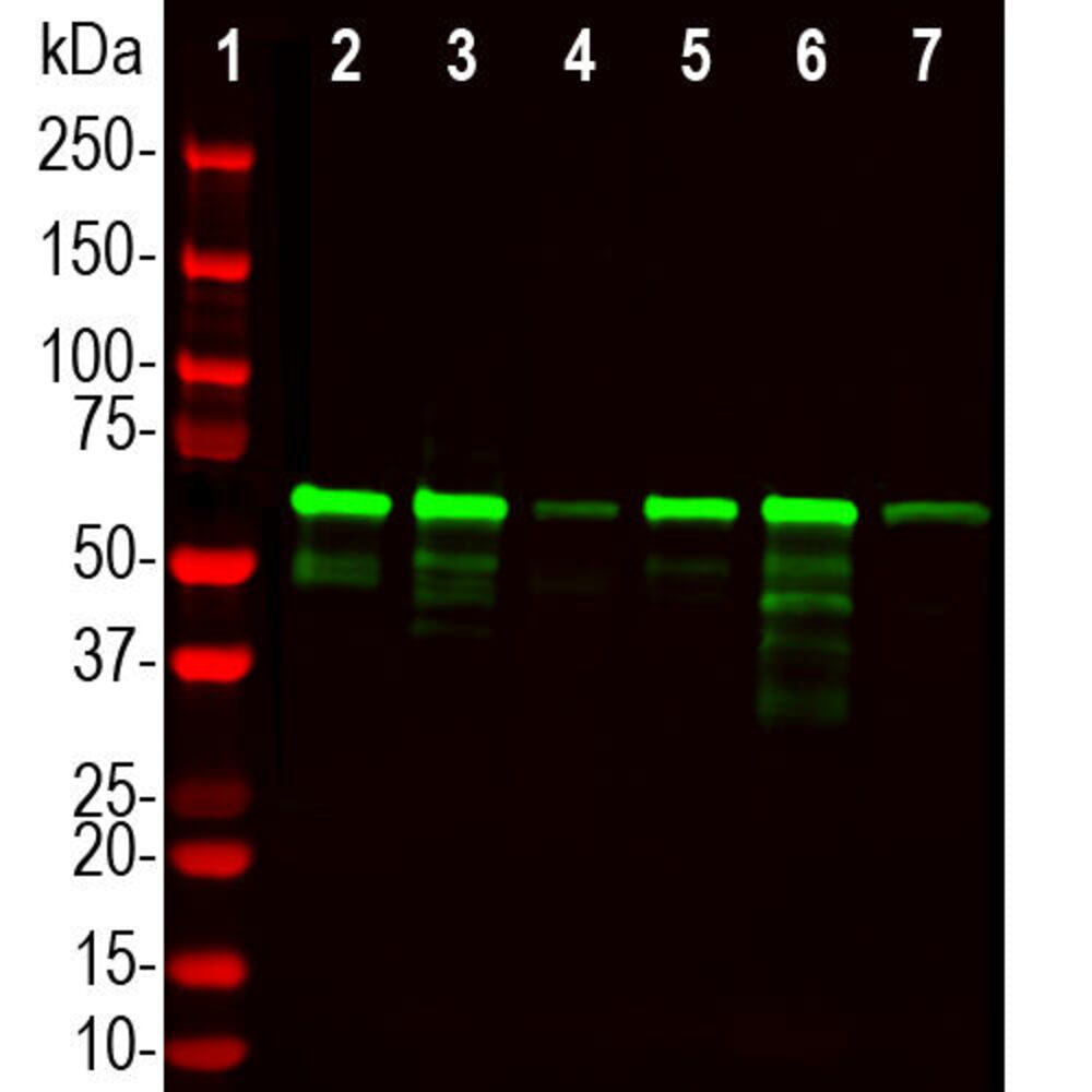 Anti-PLS1 Antibody [5F101]