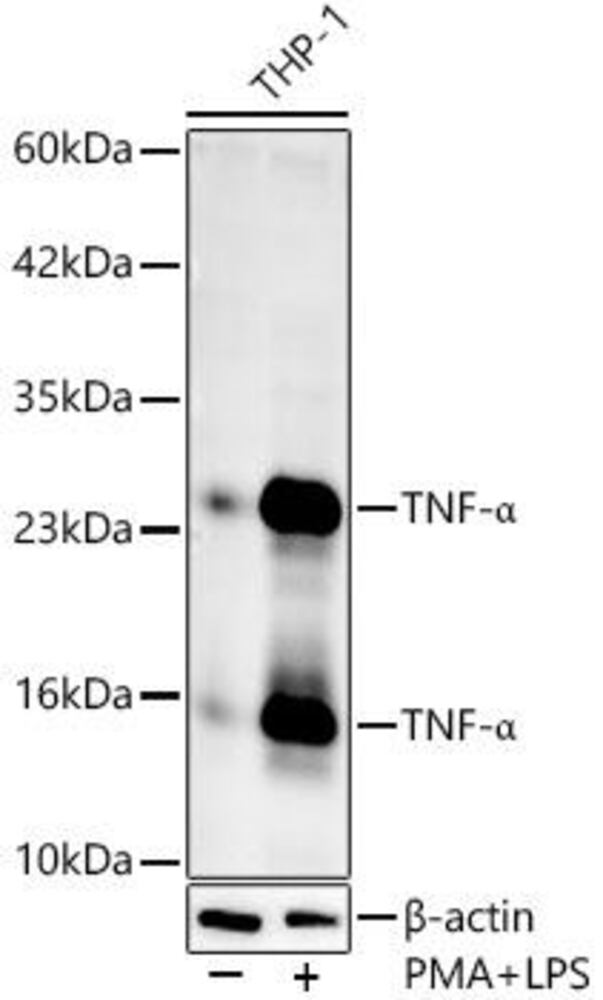 Anti-TNF alpha Antibody, 100 µl