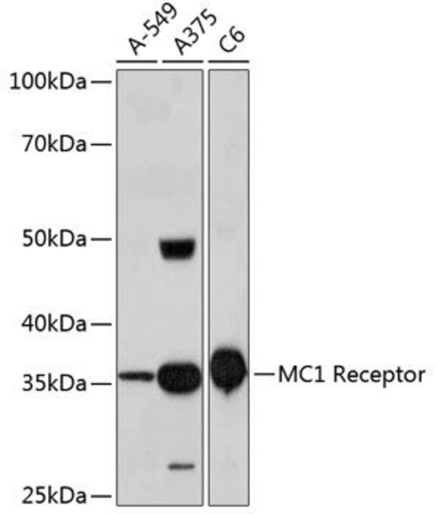 Anti-MC1-R Antibody [ARC0638]