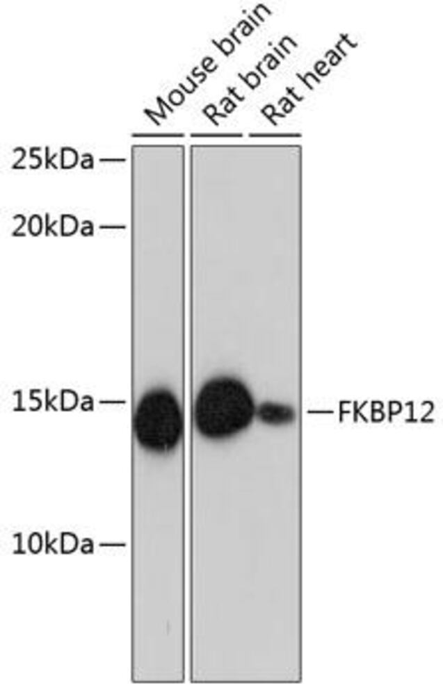 Anti-FKBP12 Antibody [ARC0654]
