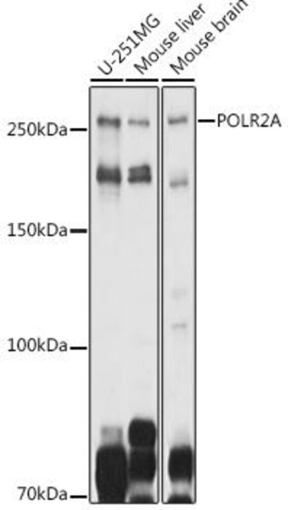 Anti-RNA polymerase II CTD repeat YSPTSP, S Antibody, 100 µl