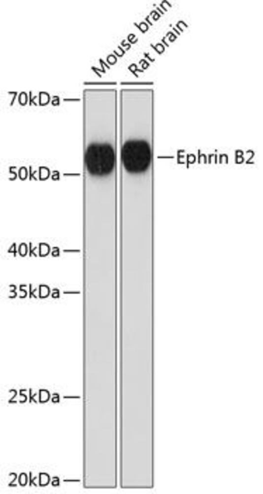 Anti-Ephrin B2 Antibody [ARC0576], 100 µl
