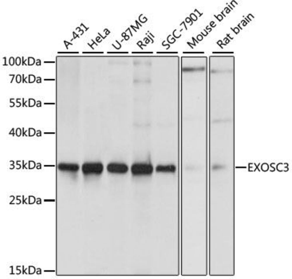 Anti-EXOSC3 Antibody, 100 µl