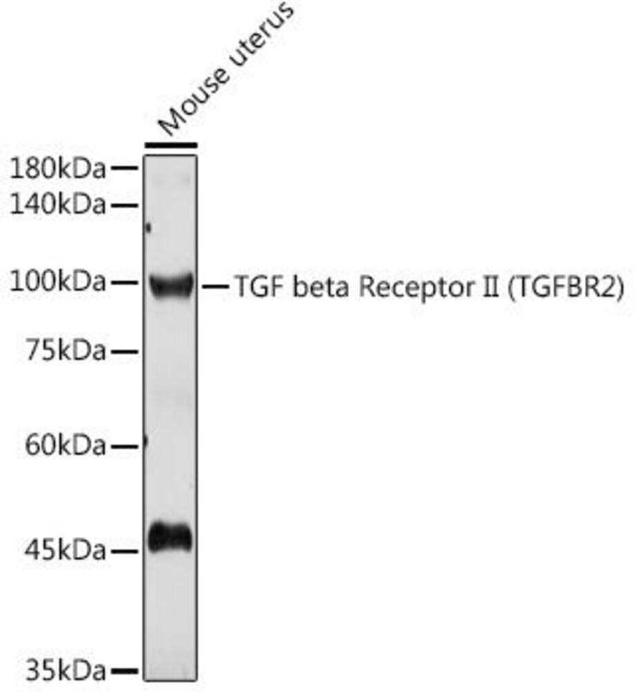 Anti-TGF beta Receptor II Antibody