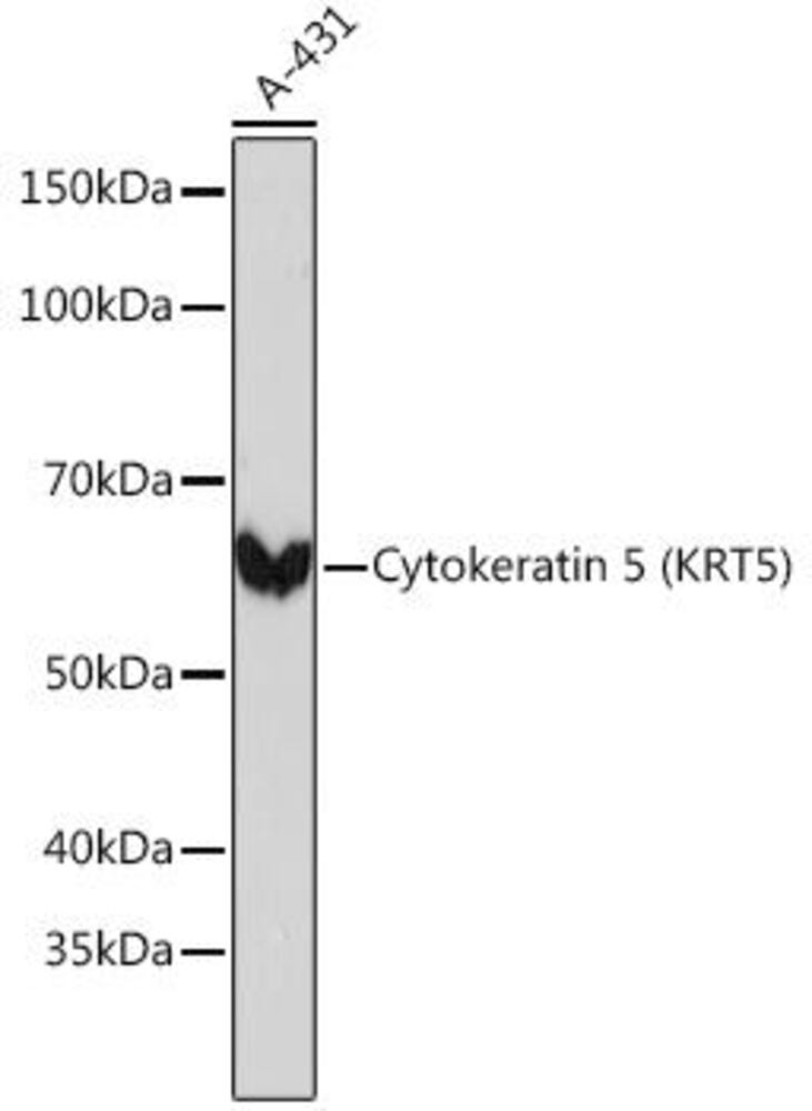 Anti-Cytokeratin 5 Antibody [ARC0585]