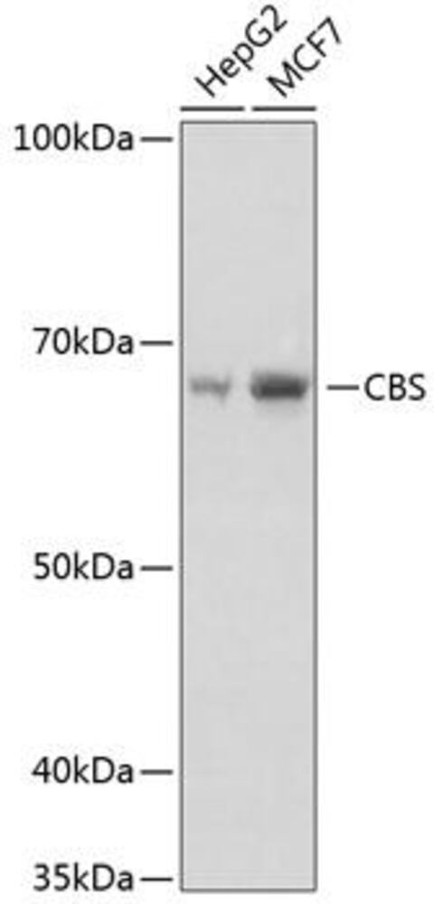 Anti-CBS Antibody [ARC0643]