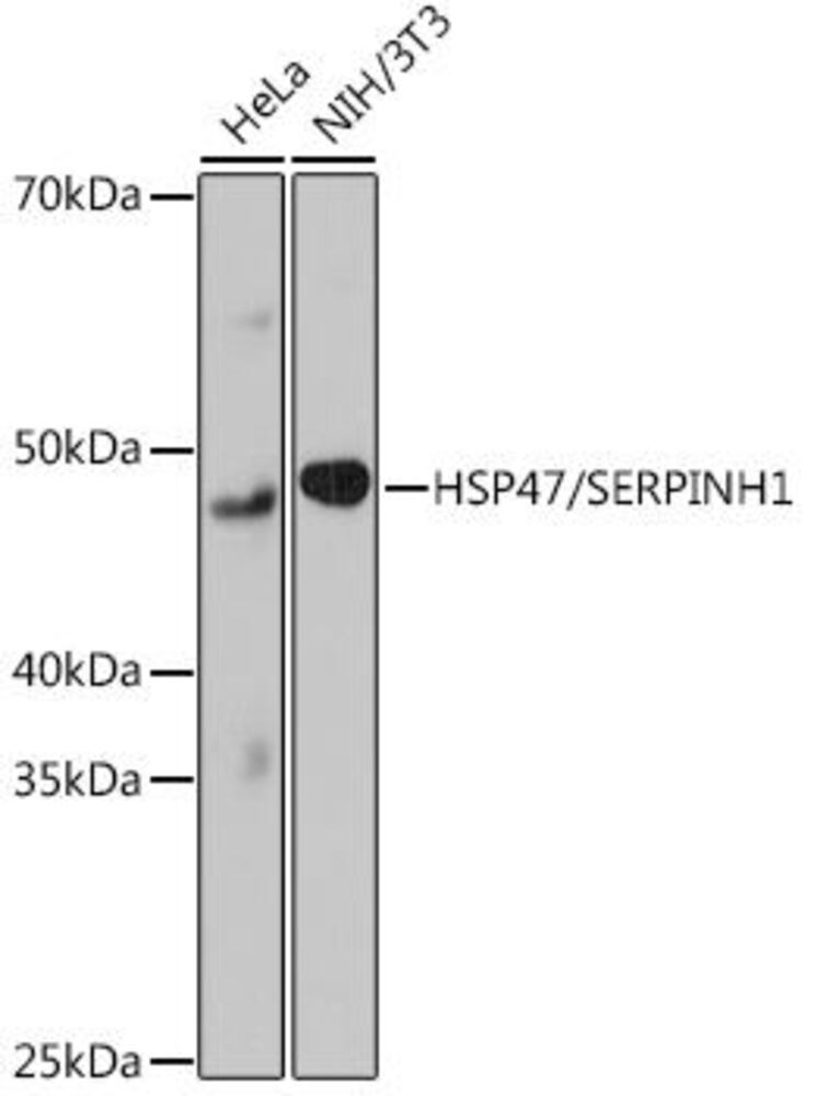 Anti-Hsp47 antibody [ARC0681], 100 µl