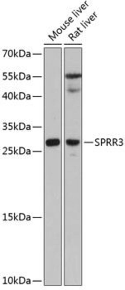 Anti-SPRR3 Antibody, 100 µl