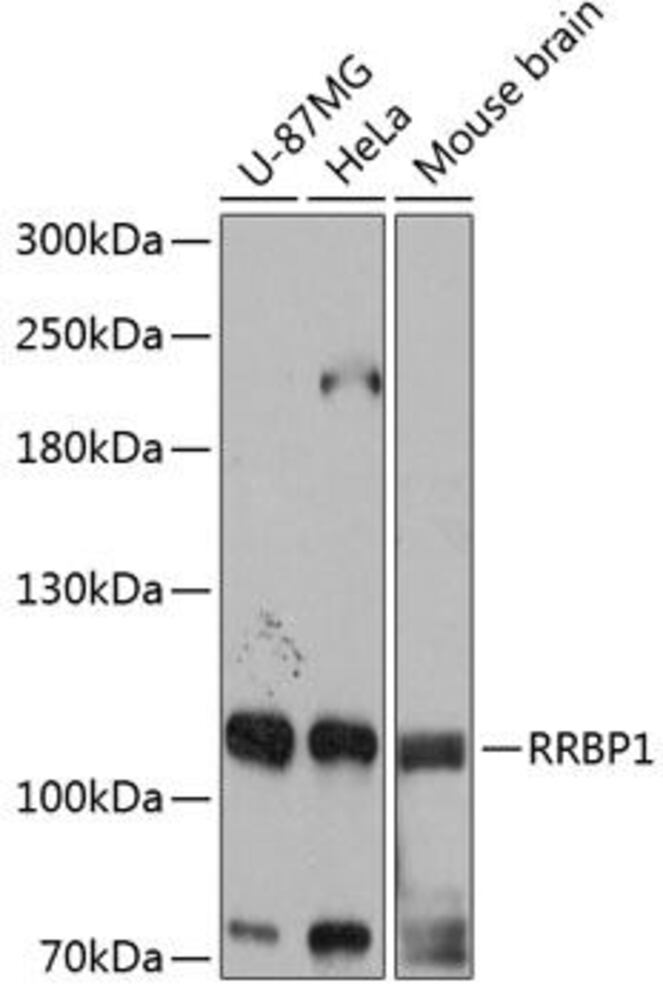 Anti-RRBP1 Antibody