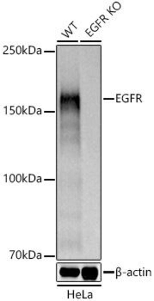 Anti-EGFR Antibody, 100 µl