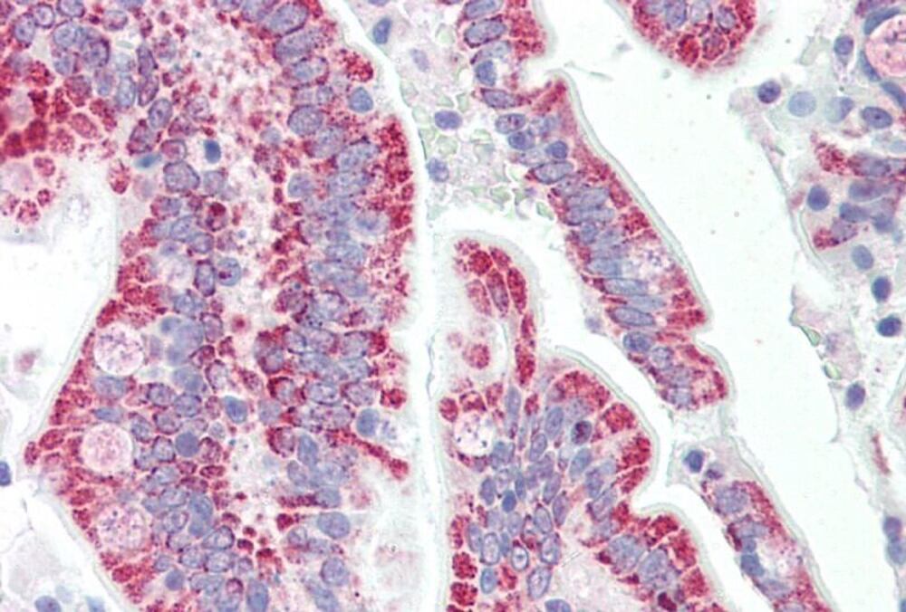 Anti-SON Antibody, 100 µg