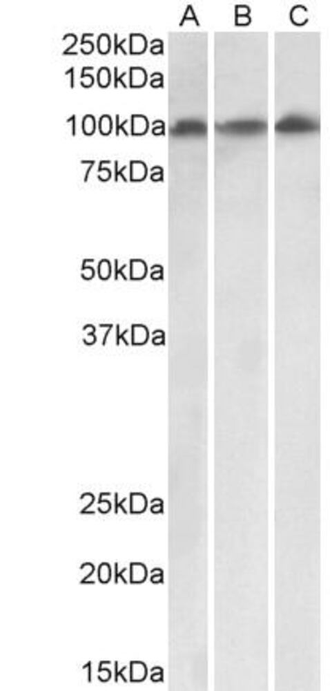 Anti-VPS16 Antibody, 100 µg