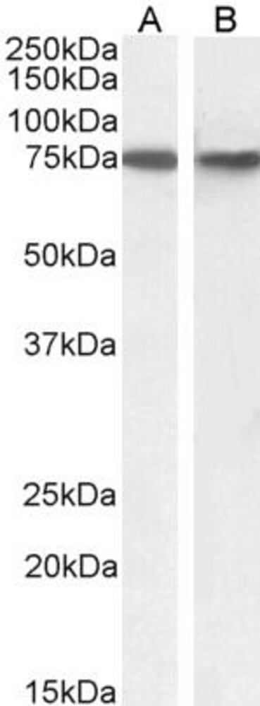 Anti-SNX1 Antibody, 100 µg