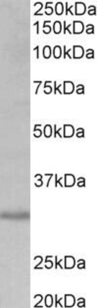Anti-CRLS1 Antibody, 100 µg