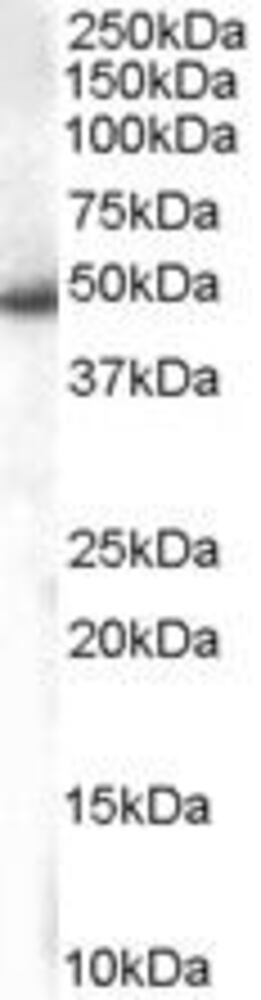 Anti-SNX5 Antibody, 100 µg
