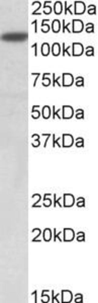 Anti-SIRT1 Antibody, 100 µg