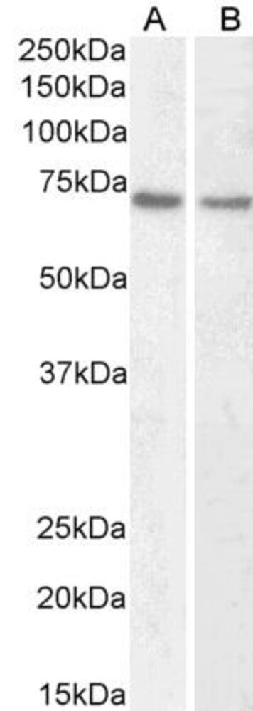 Anti-Lamin B1 Antibody, 100 µg