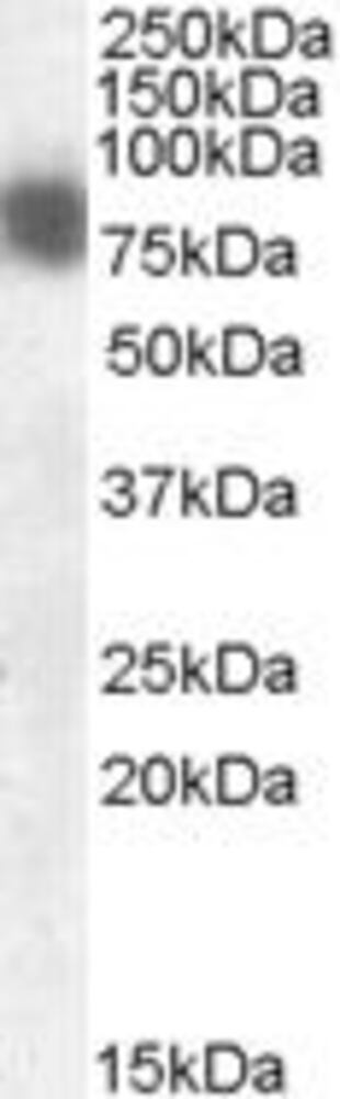 Anti-Cortactin Antibody, 100 µg