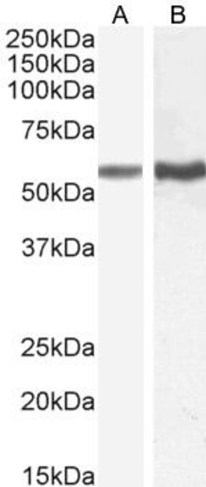 Anti-TGFBR1 antibody, 100 µg