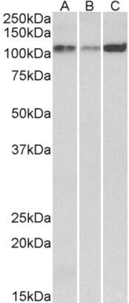 Anti-SERCA2 Antibody, 100 µg
