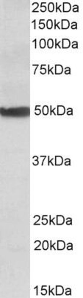 Anti-CYP24A1 Antibody