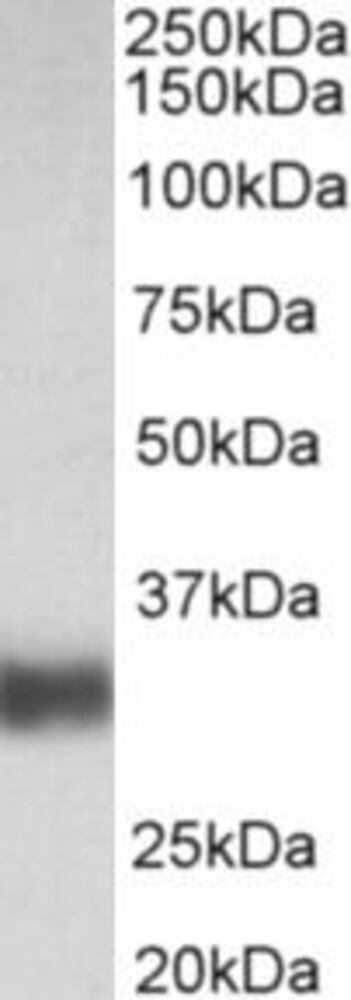 Anti-SFTPA1 Antibody, 100 µg