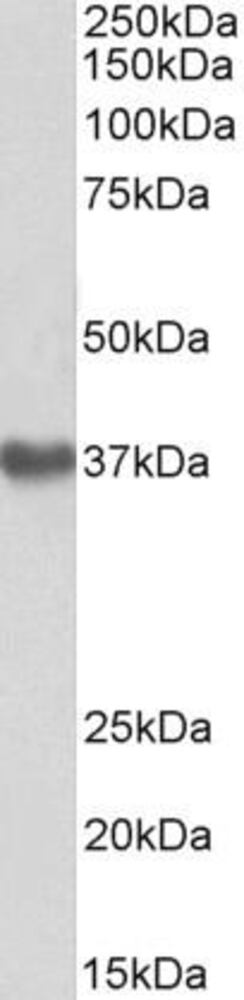 Anti-GNA12 Antibody, 100 µg