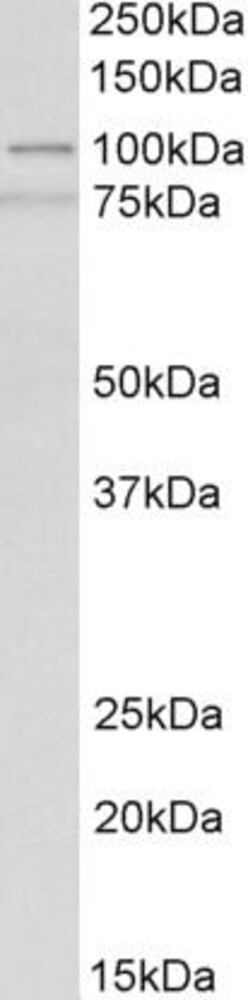 Anti-ACTN1 Antibody, 100 µg