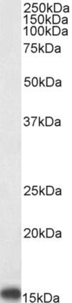 Anti-PBR Antibody