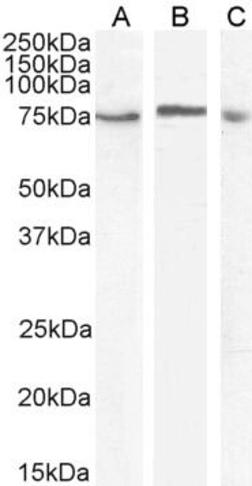 Anti-TAK1 Antibody, 100 µg