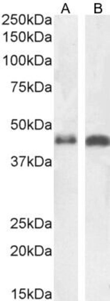 Anti-beta Arrestin 2 Antibody, 100 µg