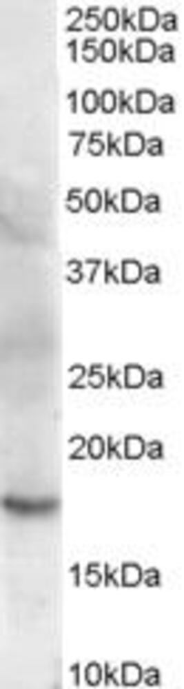 Anti-Cofilin 2 Antibody, 100 µg