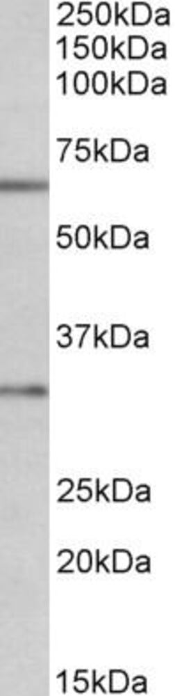 Anti-Caspase-3 Antibody, 100 µg