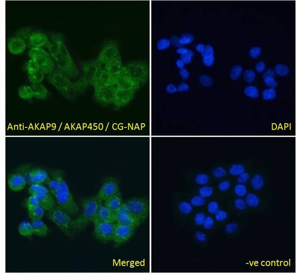 Anti-AKAP9 Antibody, 100 µg