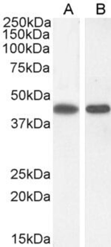 Anti-ASS1 Antibody, 100 µg