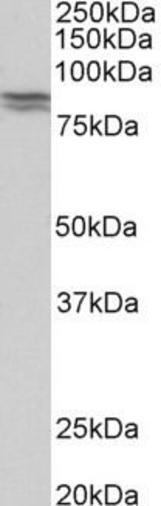 Anti-E Cadherin Antibody, 100 µg