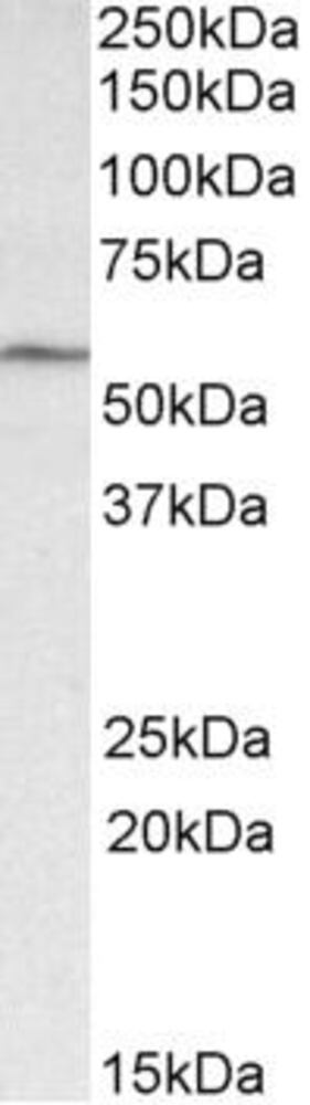 Anti-GLP-1R Antibody, 100 µg