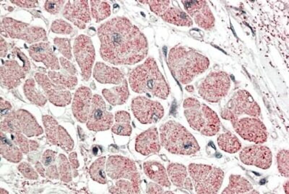 Anti-proANP Antibody