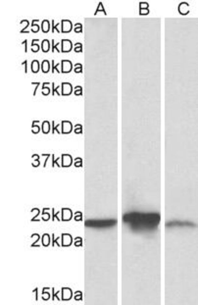 Anti-ABHD14B Antibody, 100 µg