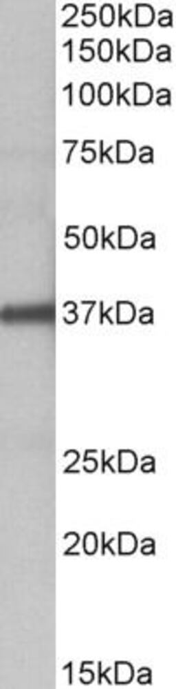 Anti-FUT2 Antibody, 100 µg