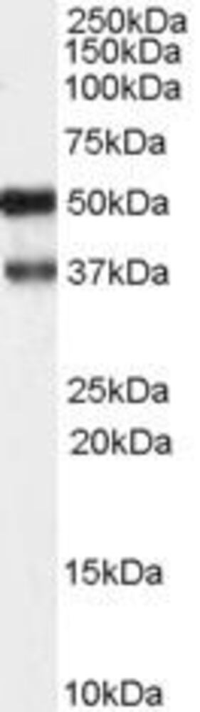 Anti-PACSIN1 Antibody, 100 µg