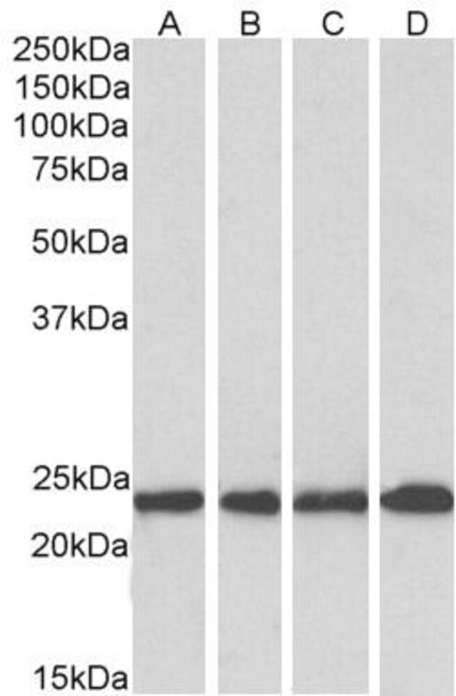 Anti-SOD2/MnSOD Antibody, 100 µg