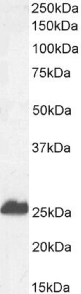 Anti-Calbindin Antibody, 100 µg
