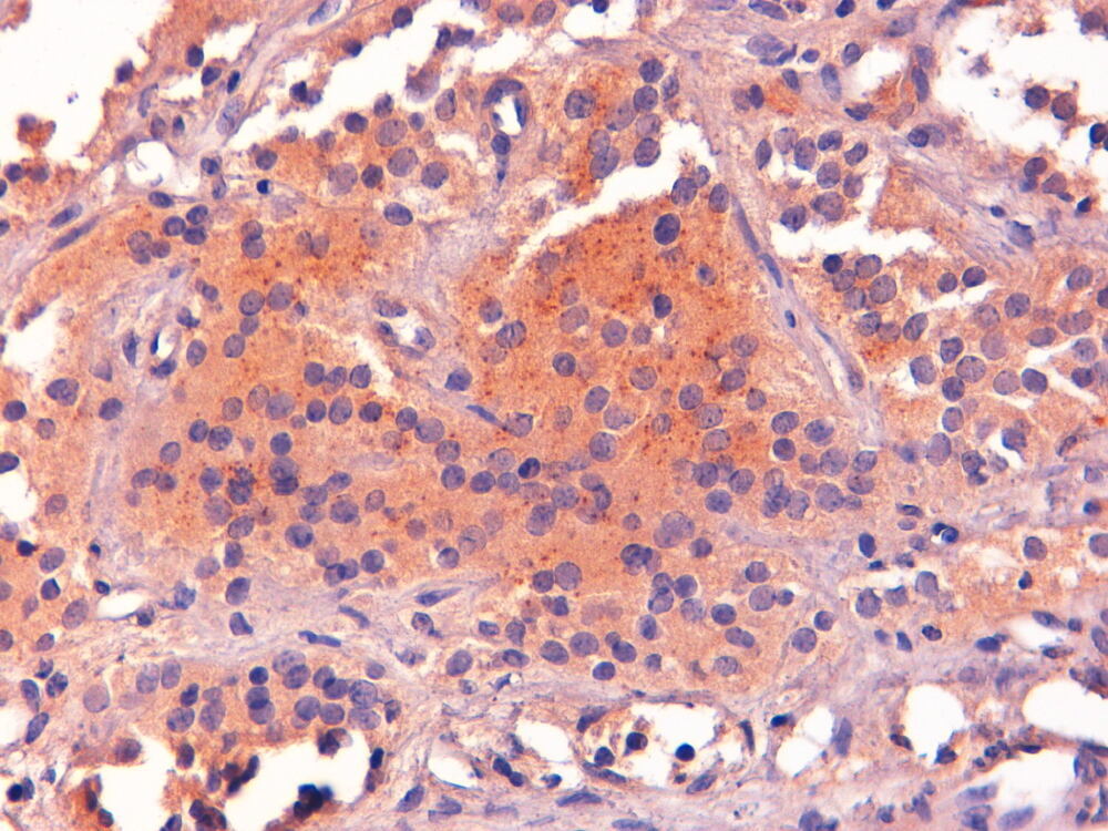 Anti-POMC Antibody, 100 µg