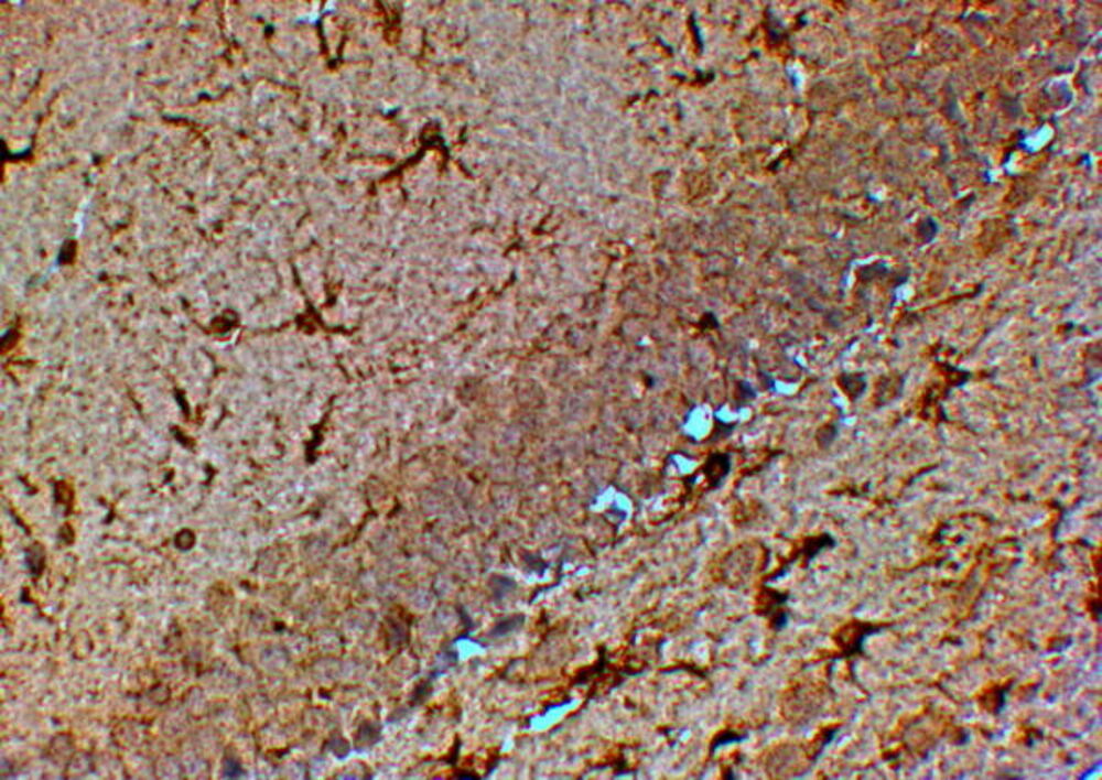 Anti-TRPM7 Antibody, 100 µg